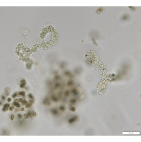 Aphanocapsa holsatica