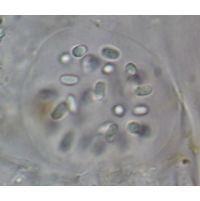 Aphanothece variabilis
