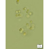 Chroococcus minor