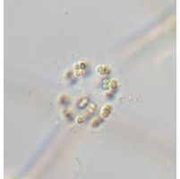 Coelosphaerium kuetzingianum