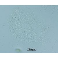 Cyanodictyon planctonicum