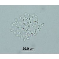 Cyanodictyon planctonicum