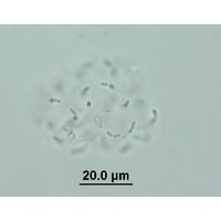 Cyanodictyon planctonicum