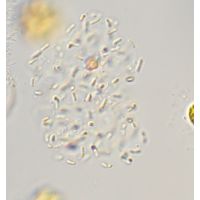 Cyanodictyon planctonicum