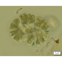 Gomphosphaeria aponina