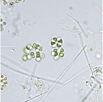 Limnococcus limneticus