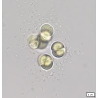 Limnococcus limneticus