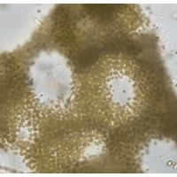 Microcystis aeruginosa