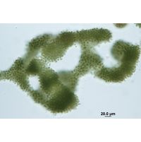 Microcystis aeruginosa