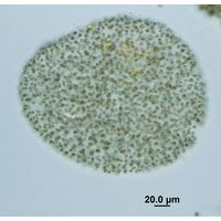 Microcystis flosaque