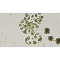 Microcystis wesenbergii