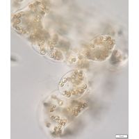 Microcystis wessenbergii