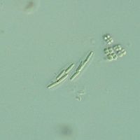 Rhabdogloea linearis