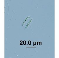 Rhabdogloea linearis