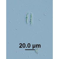Rhabdogloea linearis