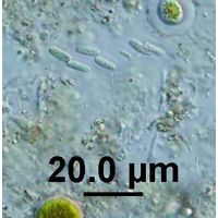 Rhabdogloea linearis