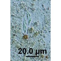 Rhabdogloea linearis