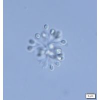 Snowella lacustris
