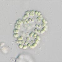 Snowella lacustris