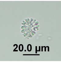Snowella lacustris 