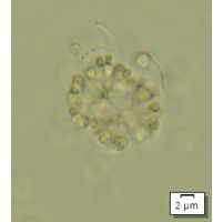 Snowella lacustris