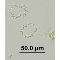 Snowella litoralis