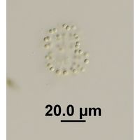 Snowella litoralis