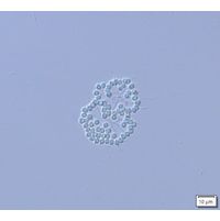 Snowella litoralis