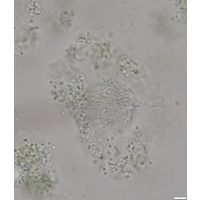 Synechococcus endogloeicus