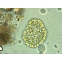 Woronichinia karelica