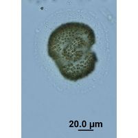 Woronichinia naegeliana
