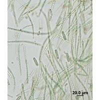 Anabaena augstumalis