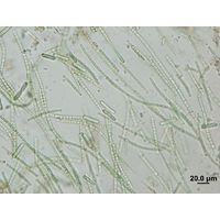 Anabaena augstumalis