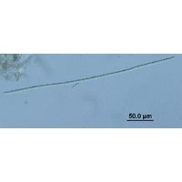 Anabaena augstumalis