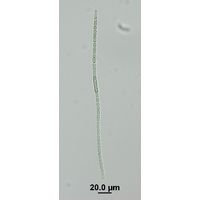 Anabaena augstumalis