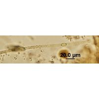 Anabaena cf. augstumalis