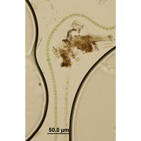 Anabaena lapponica