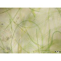 Anabaena