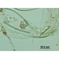 Anabaena