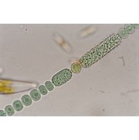 Anabaena echinospora