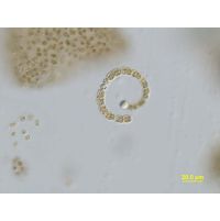 Anabaenopsis