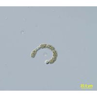 Anabaenopsis