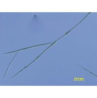 Sphaerospermopsis aphanizomenoides