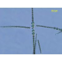 Sphaerospermopsis aphanizomenoides