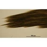 Aphanizomenon flos-aquae