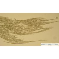 Aphanizomenon flos-aquae