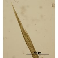 Aphanizomenon flos-aquae