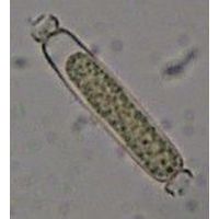 Aphanizomenon gracile