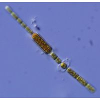 Aphanizomenon gracile