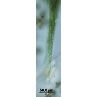 Aphanizomenon 